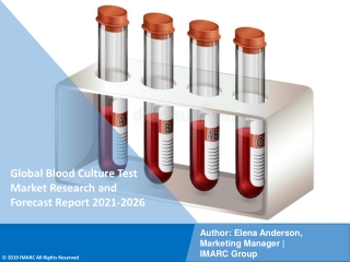Blood Culture Test Market PDF 2021-2026: Size, Share, Trends, Analysis