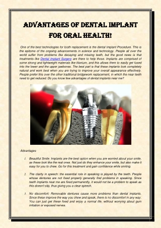 Advantages of Dental Implant For Oral health-converted