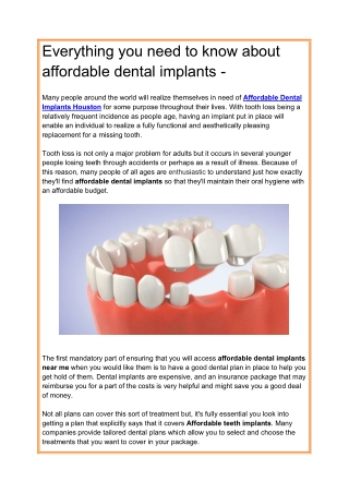 Everything you need to know about affordable dental implants