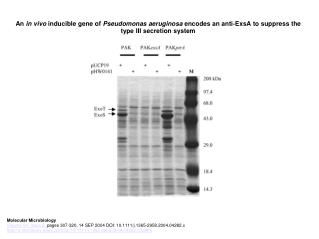 An in vivo inducible gene of Pseudomonas aeruginosa encodes an anti‐ExsA to suppress the type III secretion system