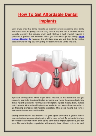 How To Get Affordable Dental Implants