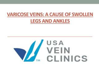 Varicose Veins: A Cause of Swollen Legs and Ankles