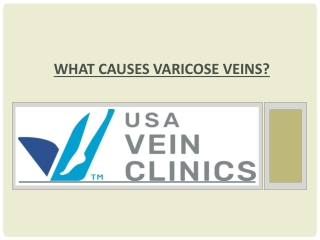 What Causes Varicose Veins