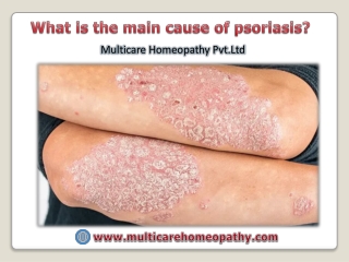 What is the main cause of psoriasis ?