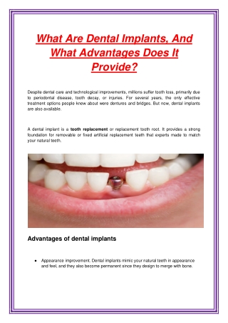 What Are Dental Implants, And What Advantages Does It Provide