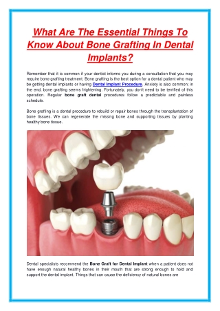 What Are The Essential Things To Know About Bone Grafting In Dental Implants