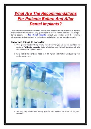 What Are The Recommendations For Patients Before And After Dental Implants
