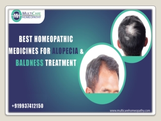 Best Homeopathic Medicine for ALOPECIA & BALDNESS Treatment at Multicare Homeopathy