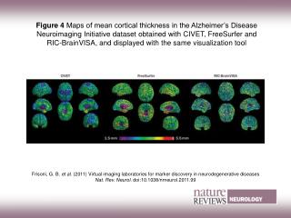 Figure 4 Maps of mean cortical thickness in the Alzheimer’s Disease Neuroimaging Initiative dataset obtained with CIVET