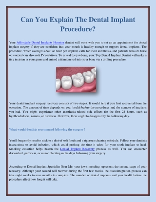 Can You Explain The Dental Implant Procedure?