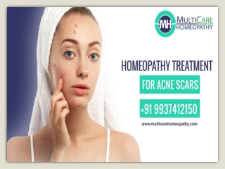 Effective Homeopathy Treatment for Acne at Multicare Homeopathy