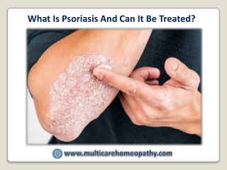 What is Psoriasis and Can It Be Treated?