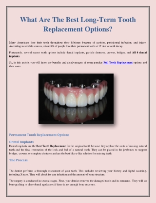 What Are The Best Long-Term Tooth Replacement Options?