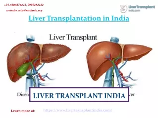 The Best Liver Transplantation in India