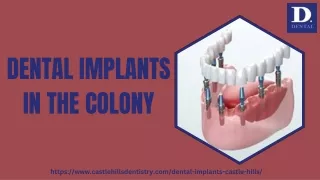 Dental Implants in The Colony. pptx