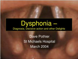 Dysphonia – Diagnosis, Decisive action and other Delights