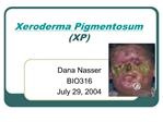 Xeroderma Pigmentosum XP