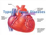 Different types of Heart Disease