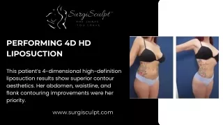 Performing 4D HD Liposuction