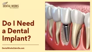 Do I Need a Dental Implant?
