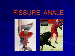 FISSURE ANALE