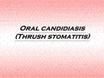 Oral candidiasis Thrush stomatitis