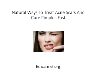 Natural Ways To Treat Acne Scars And Cure Pimples Fast