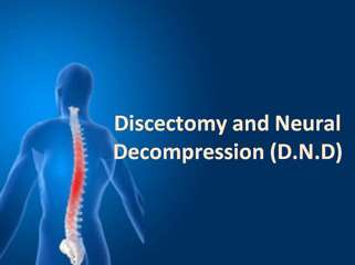discectomy and neural decompression (d.n.d)
