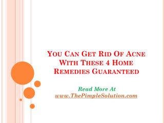 4 Home Remedies to get rid of acne
