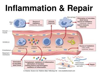 PPT - Inflammation & Repair PowerPoint Presentation - ID:1993668