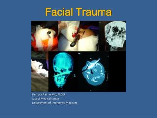 emergency facial trauma treatment free insest sex video