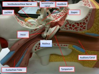 Ppt - Superior Semicircular Canal Dehiscence Syndrome Powerpoint 