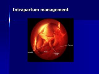 PPT - INTRAPARTUM CARE PowerPoint Presentation - ID:3266098