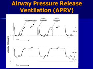 PPT - MECHANICAL VENTILATION IN PEDIATRICS PowerPoint Presentation - ID ...