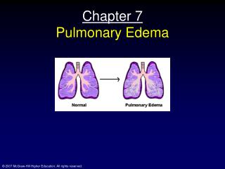 pulmonary edema treatment