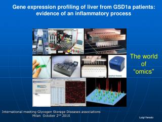 Gene expression profiling of liver from GSD1a patients: evidence of an inflammatory process