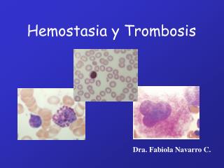 Hemostasia y Trombosis