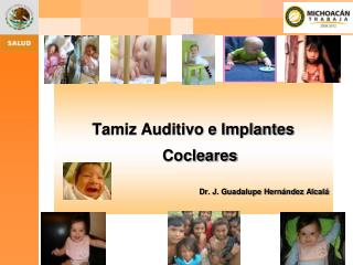 Tamiz Auditivo e Implantes Cocleares Dr. J. Guadalupe Hernández Alcalá