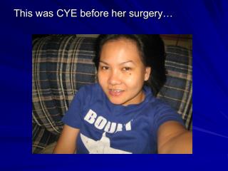 This was CYE before her surgery…