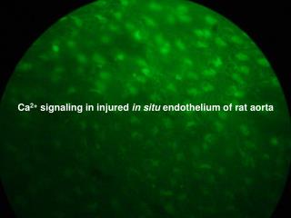 Ca 2+ signaling in injured in situ endothelium of rat aorta