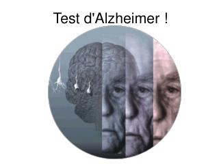 Test d'Alzheimer !