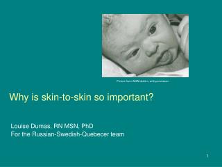 Why is skin-to-skin so important?