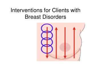 Interventions for Clients with Breast Disorders
