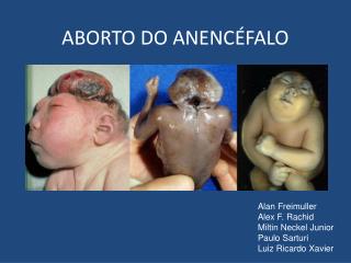 ABORTO DO ANENCÉFALO