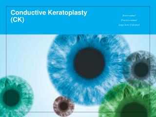 Conductive Keratoplasty (CK)