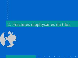 2. Fractures diaphysaires du tibia