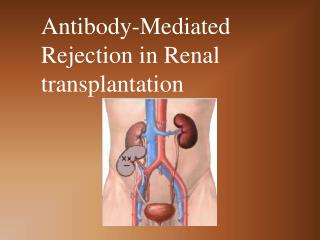 Antibody-Mediated Rejection in Renal transplantation