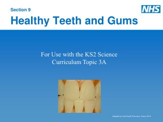 Section 9 Healthy Teeth and Gums