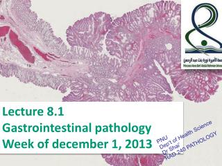 Lecture 8.1 Gastrointestinal pathology Week of december 1, 2013