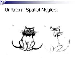 Unilateral Spatial Neglect